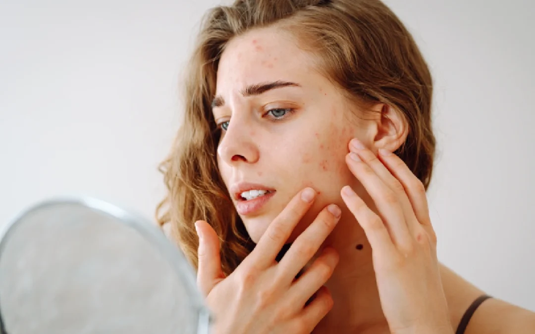 How Pollution Damages Your Skin & What You Can Do